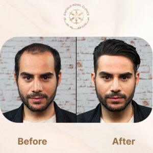 hair wig after before