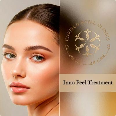 Inno Peel Treatment in Islamabad