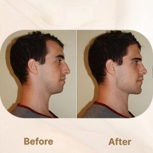 jaw surgery in islamabad pakistan