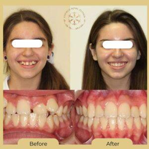 teeth aligners in islamabad