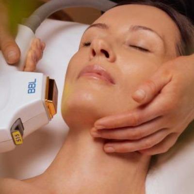 Different Types of Laser Treatments for Facial Skin