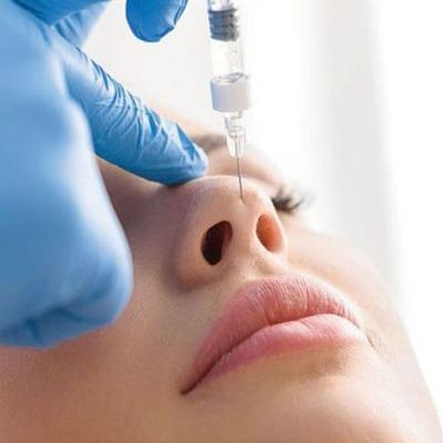 How many times can you do nose fillers