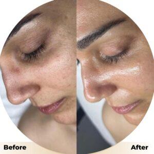 best affordable hdrafacail in islamabad