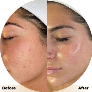 best hydrafacail in islamabad
