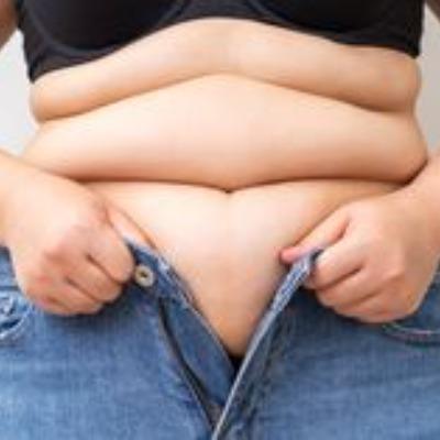 Abdominoplasty Recovery Timeline: Week-by-Week