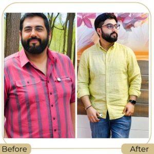 Best Bariatric Weight Loss Surgeon in Islamabad, Pakistan after