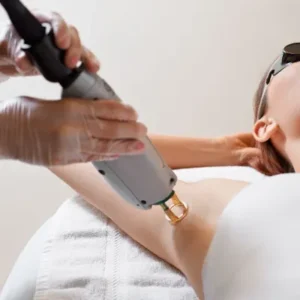 Best Laser Hair Removal for men in Islamabad