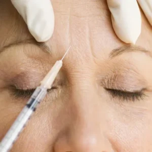 Can Botox Remove Deep Wrinkles Full Guide
