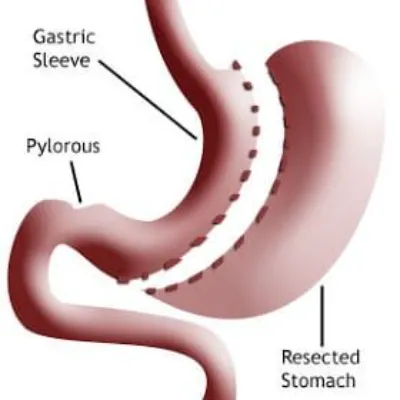 Clinics Trusted by Bariatric Patients in Islamabad