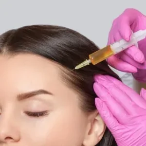 Exosomes Hair Therapy in Islamabad: Best Treatment for Hair Loss