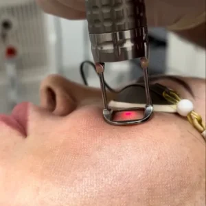 Expert Dermatologists for CO2 Laser in Islamabad