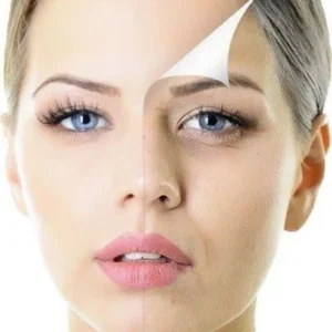 Get Brighter Skin with Skin Whitening Treatments in Islamabad