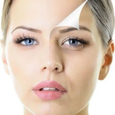 Get Brighter Skin with Skin Whitening Treatments in Islamabad