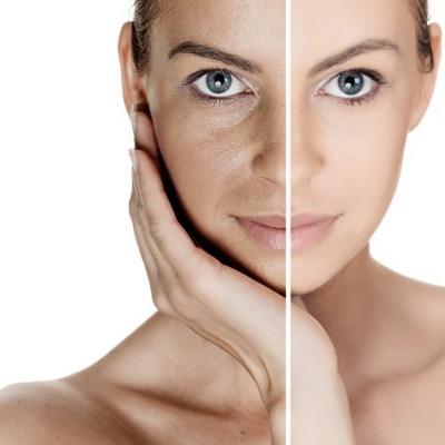 How Long Does It Take to See Skin Whitening Results?
