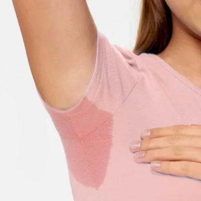 Hyperhidrosis treatment in islamabad