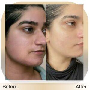 IV Vitamin Therapy islamabad pakistan
