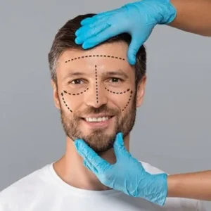 Is Rhinoplasty Expensive in Islamabad