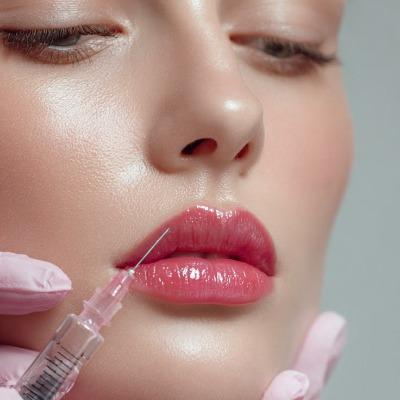 Lip Augmentation in Islamabad