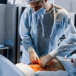 Liposuction Surgery in Islamabad