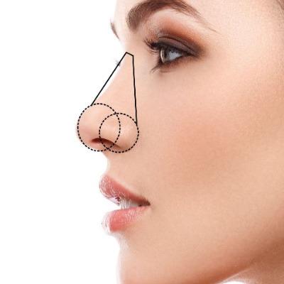 Nose Job in Islamabad Advanced Rhinoplasty for Best Result