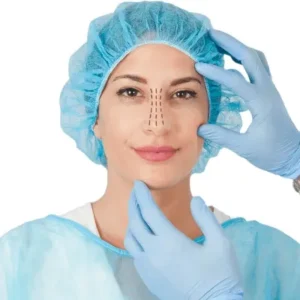 Rhinoplasty Procedure and Recovery in Islamabad