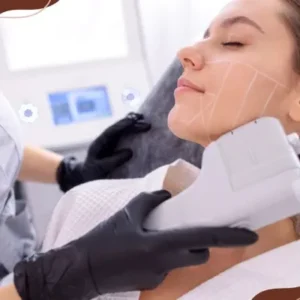 Top 10 Reasons to Consider HIFU for Skin Tightening