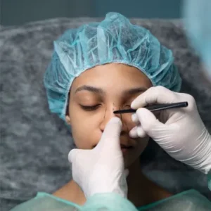 Can I Correct Previous Bad Nose Surgery in Islamabad