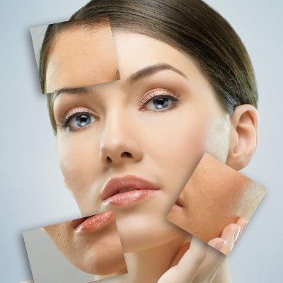 Can Skin Whitening Damage Natural Skin Tone?