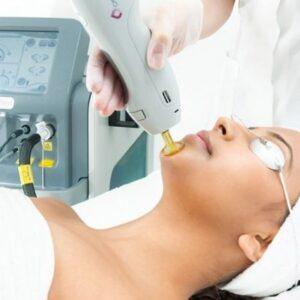 Long Lasting Hair Removal in Islamabad