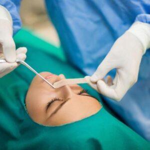 Perfect Nose Reshaping with Advanced Rhinoplasty in Islamabad