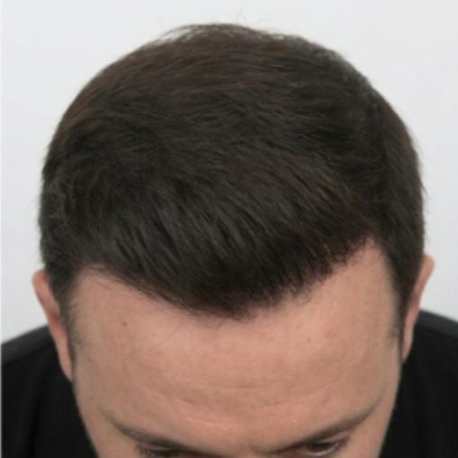 image_2_right