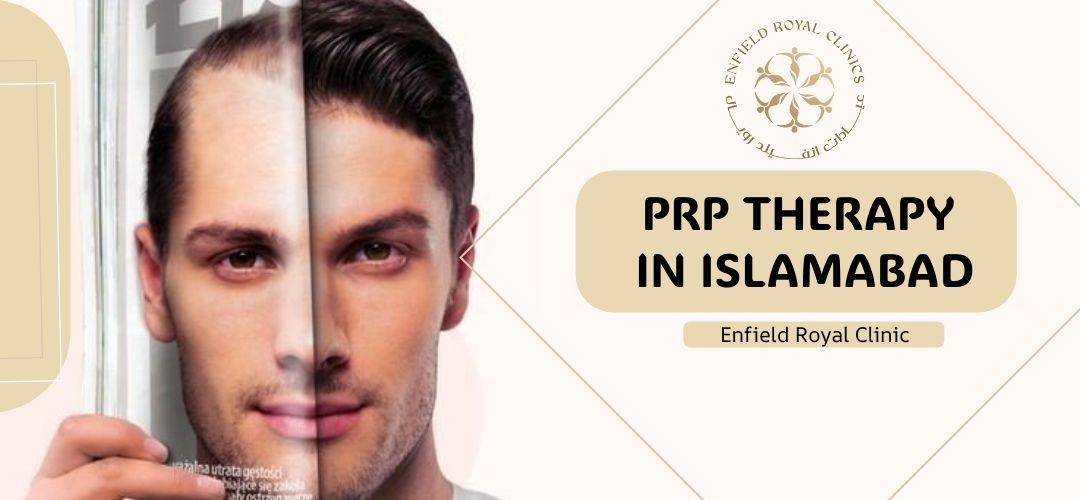 prp hair theray islamabad rawalpindi