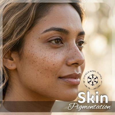 skin pigmentation islamabad