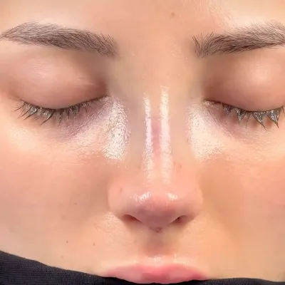 Cartilage Reshaping Techniques in Nose Surgery, Islamabad