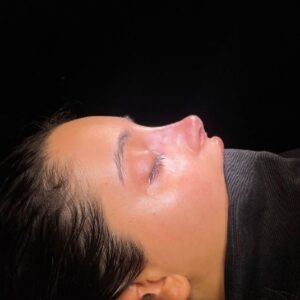 Is Rhinoplasty in Islamabad a Safe Cosmetic Procedure
