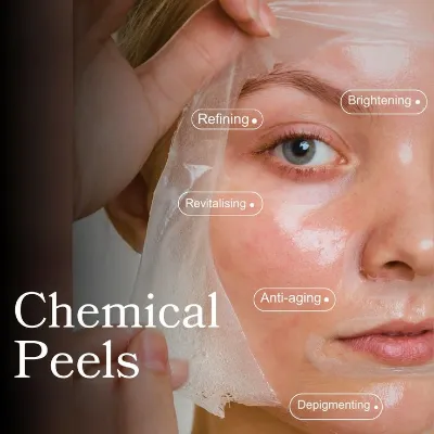 chemical peel in islamabad